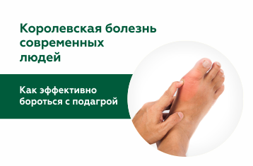 Подагра — королевская болезнь: причины, симптомы и как лечить