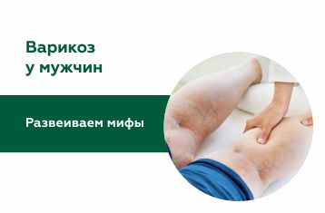 Мифы о мужском варикозе