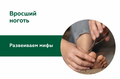 Мифы и истины о вросшем ногте: вопросы эксперту