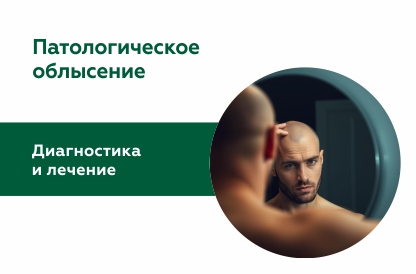Андрогенная алопеция