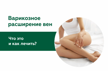 Нужно ли бояться варикоза сегодня?