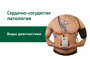 Зачем нужно проверять сердце?