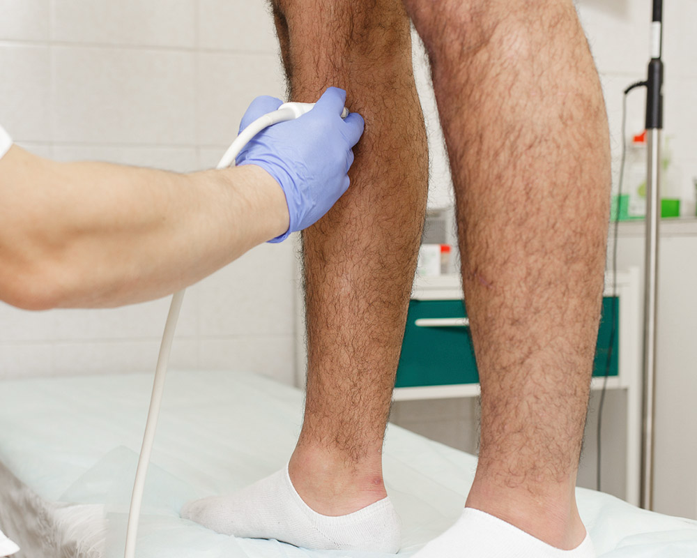 УЗИ сосудов нижних конечностей