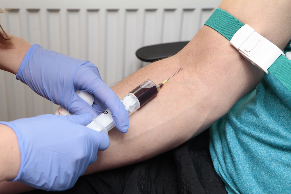 Описание процедуры плазмотерапии в Воронеже