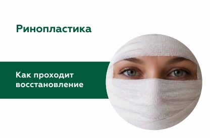 Восстановление после ринопластики: этапы, сроки и ограничения